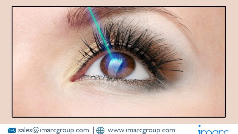 Ophthalmic Lasers Market Size Projected to Reach US$ 1.6 Billion by 2027
