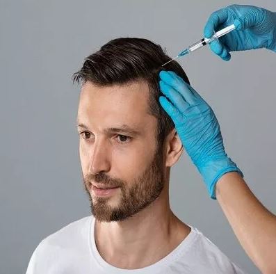 Does PRP regrow hair permanently?
